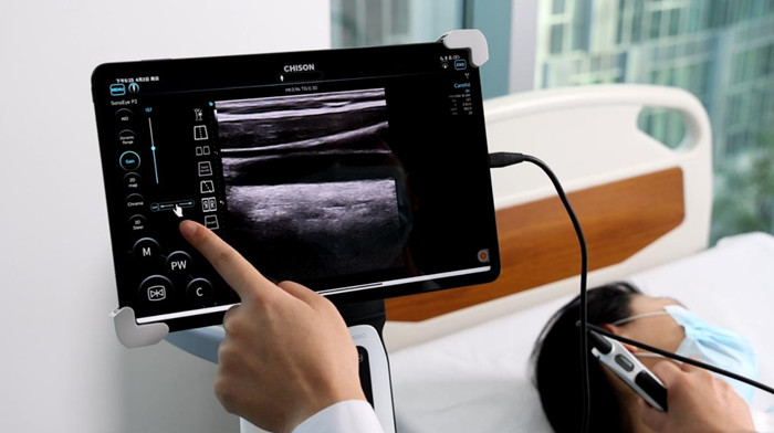 What are the Benefits of Handheld Ultrasound in Primary Care and Internal Medicine?cid=4