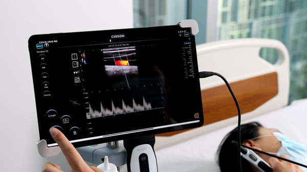 For Which Care Areas Is Handheld Ultrasound Suitable?cid=4