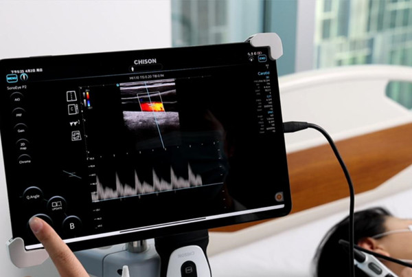 What is the Use of a Pocket-Size Handheld Ultrasound Machine in Emergency Medicine?cid=4