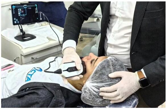 SonoEye Handheld Ultrasound in Plastic Surgery