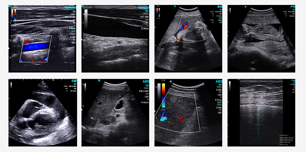 Study Confirms SonoEye as Top-Rated Handheld Ultrasound Device