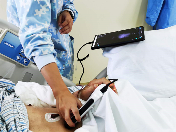 The Role of Handheld Ultrasound in Modern Point of Care