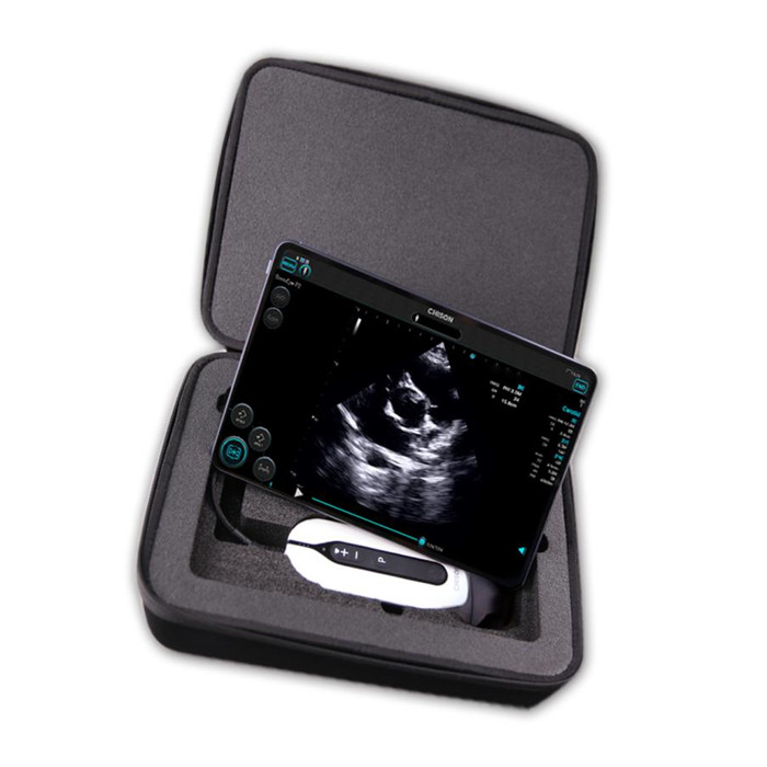 The Role of Handheld Ultrasound in Modern Point of Care