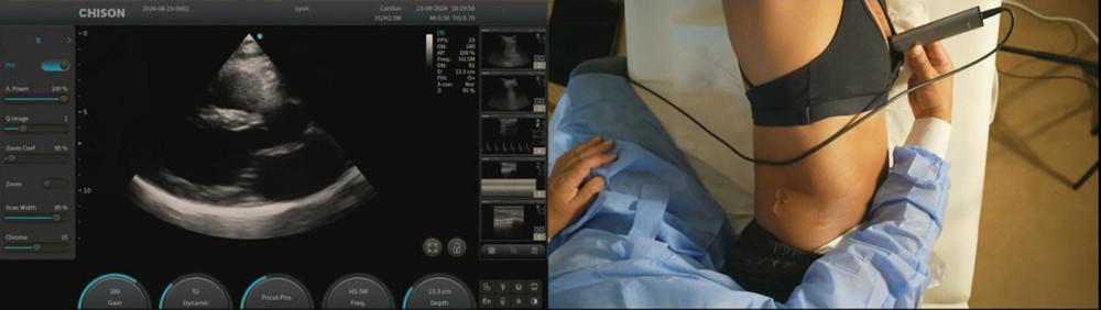 How Does Ultrasound Work?cid=4