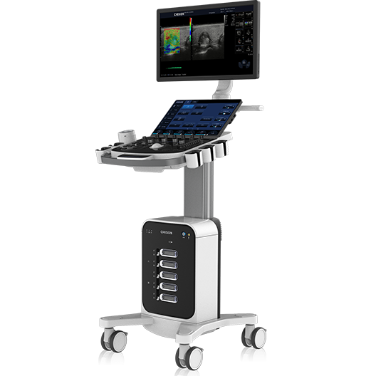 Cart-based Ultrasound