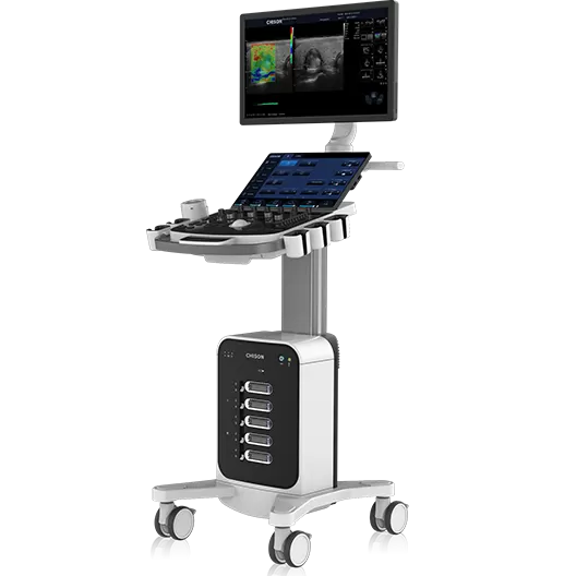 Cart-based Ultrasound