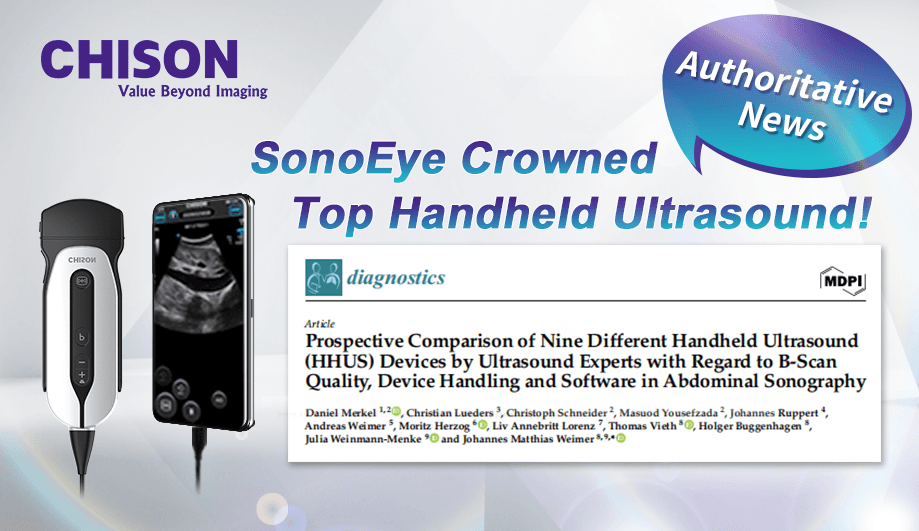 Study Confirms SonoEye as Top-Rated Handheld Ultrasound Device